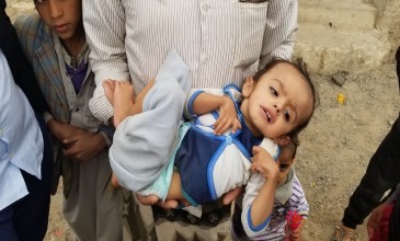 في صمت يموتون جوعاً - قصه انسانيه من اليمن